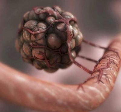 शोधकर्ताओं ने इम्यूनोथेरेपी के असर का अनुमान लगाने के लिए जेनेटिक फिंगरप्रिंट का पता लगाया