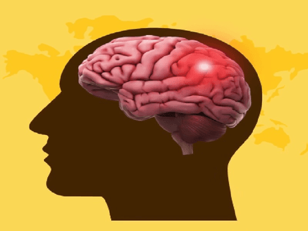 विश्व स्ट्रोक दिवस 2025: ब्रेन स्ट्रोक से बचने के लिए जीवनशैली में करें बदलाव, नहीं होगी परेशानी