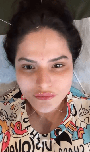 फेशियल एक्यूपंक्चर: चेहरे की चमक बढ़ाने के साथ कई समस्याओं का समाधान है छोटी सी ‘सुई’