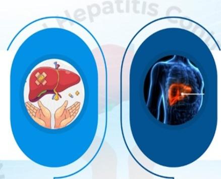 विश्व हेपेटाइटिस दिवस : हर साल 13 लाख लोगों की जान ले रहा हेपेटाइटिस, समय पर जांच और इलाज से बचाई जा सकती हैं लाखों जिंदगियां